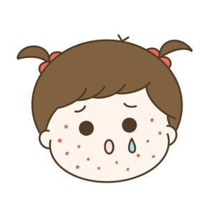 発疹