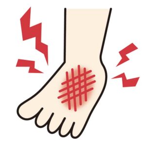 怪我足の甲